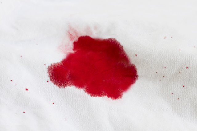 How to Remove Dried Blood Stains from Silk
